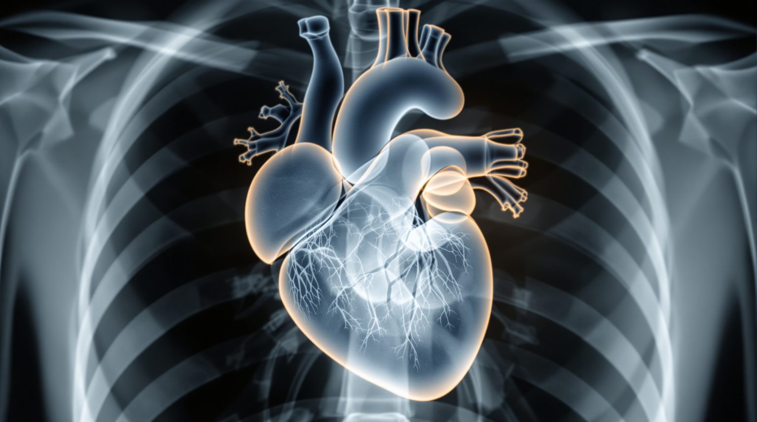 Silhouette cardio médiastinale : Comprendre son importance pour le diagnostic médical